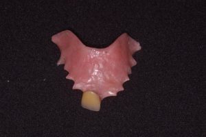 flipper denture teeth