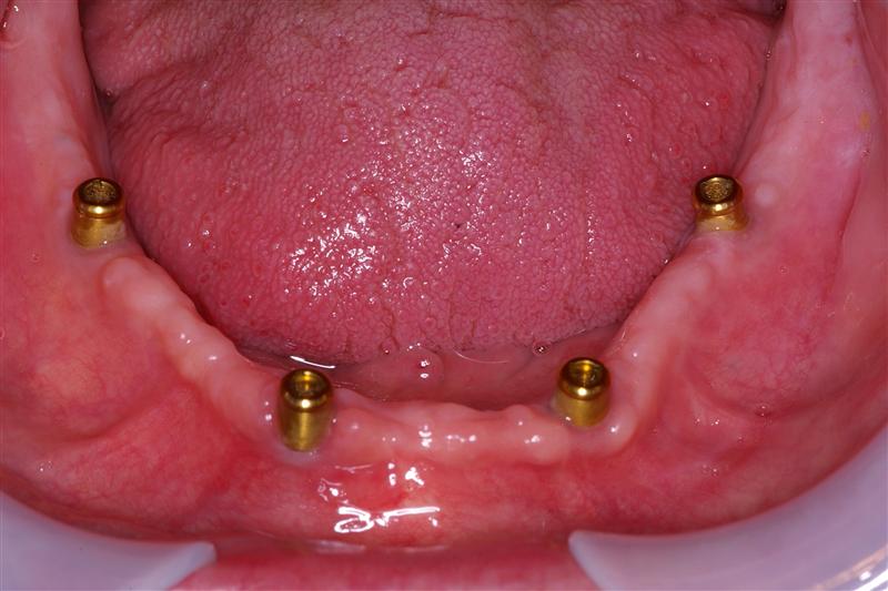 Locators Ask A Dentist