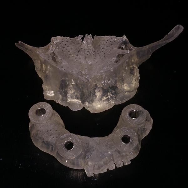 Flat Maxilla The Unexpected Link To Your Oral Health - bixy3u4