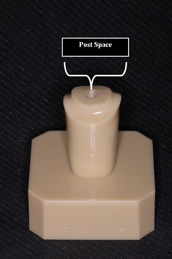 Post Space Ask A Dentist