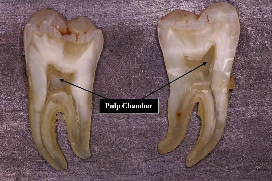 tooth pulp
