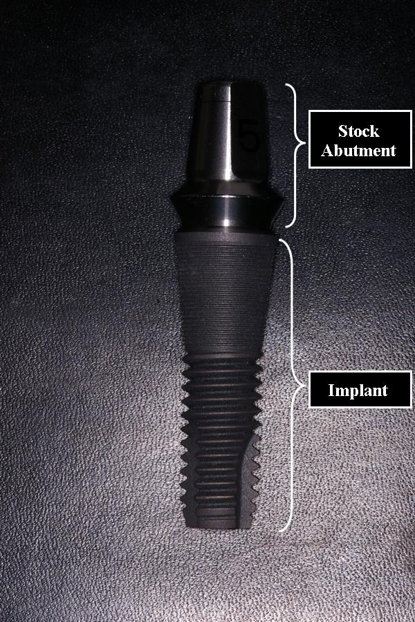 Stock Abutment Ask A Dentist